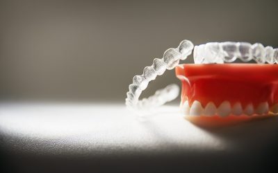 ¿Cuáles son los problemas dentales más comunes?