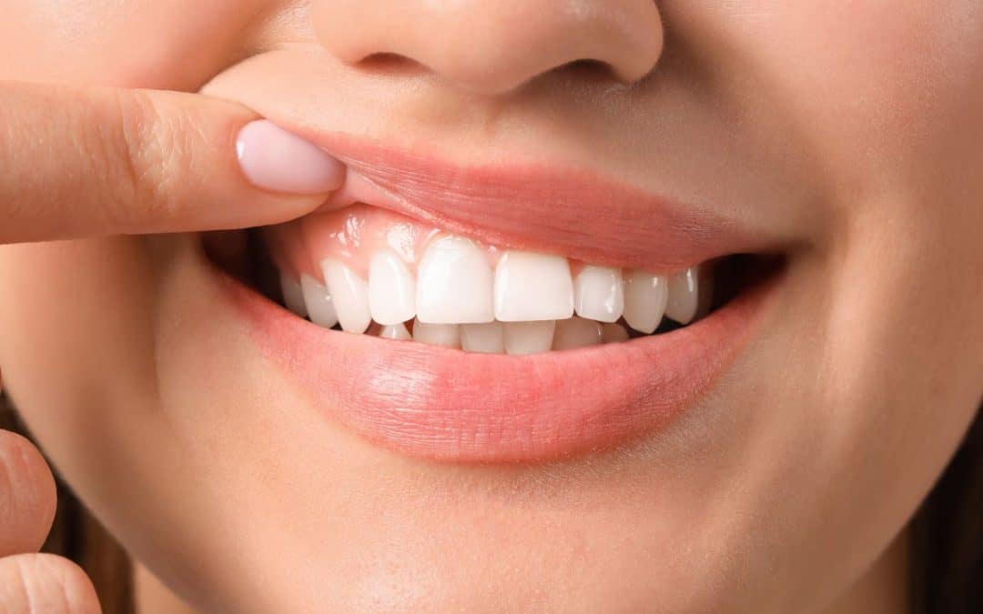 Prevenir la inflamación de encías es fundamental para mantener la salud oral