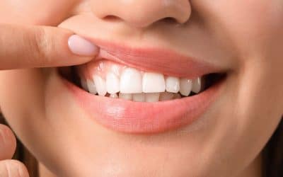 Cómo tratar la inflamación de encías: Guía para una sonrisa saludable