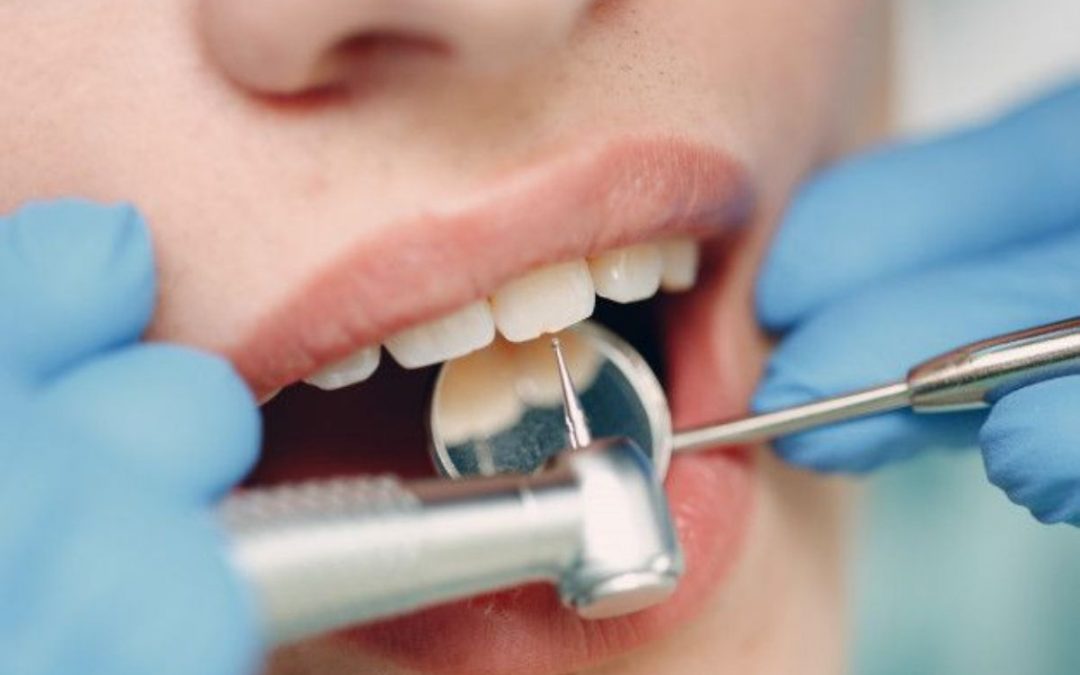 Todo lo que tienes que saber sobre la inflamación de encías
