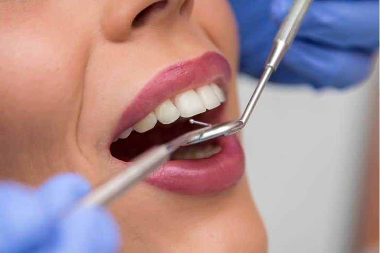 ¿Qué es la abrasión dental?